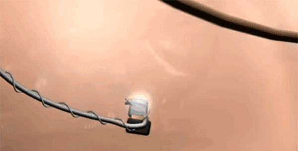 霍金是如何靠轮椅实现发音写作自由的?